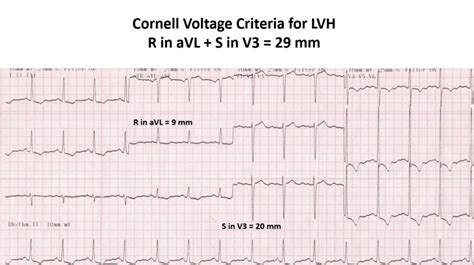 minimal voltage criteria for lvh